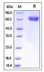 Influenza, His Tag on SDS-PAGE under reducing (R) condition. The gel was stained overnight with Coomassie Blue. The purity of the protein is greater than 95%.